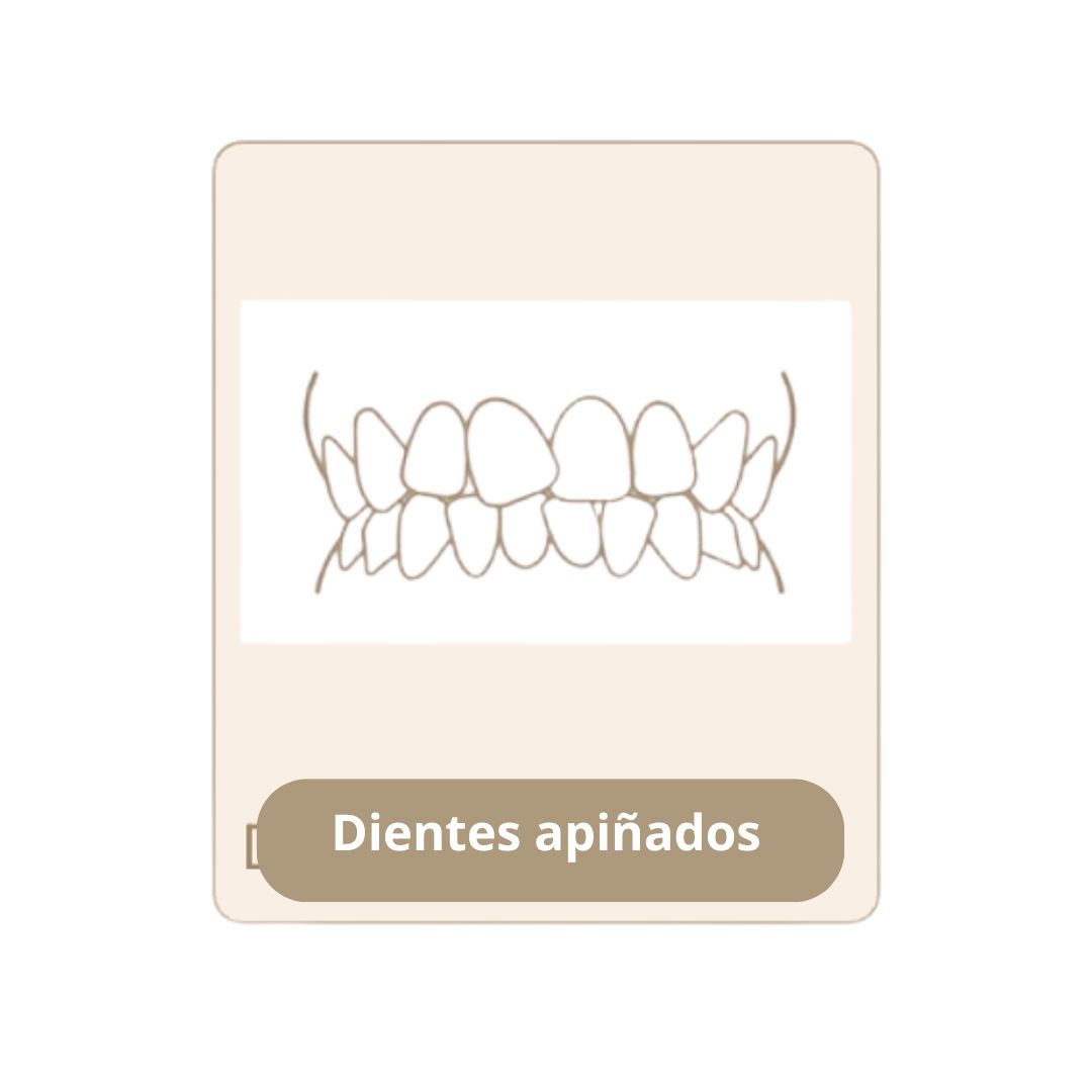 Dientes apilñados First Dental