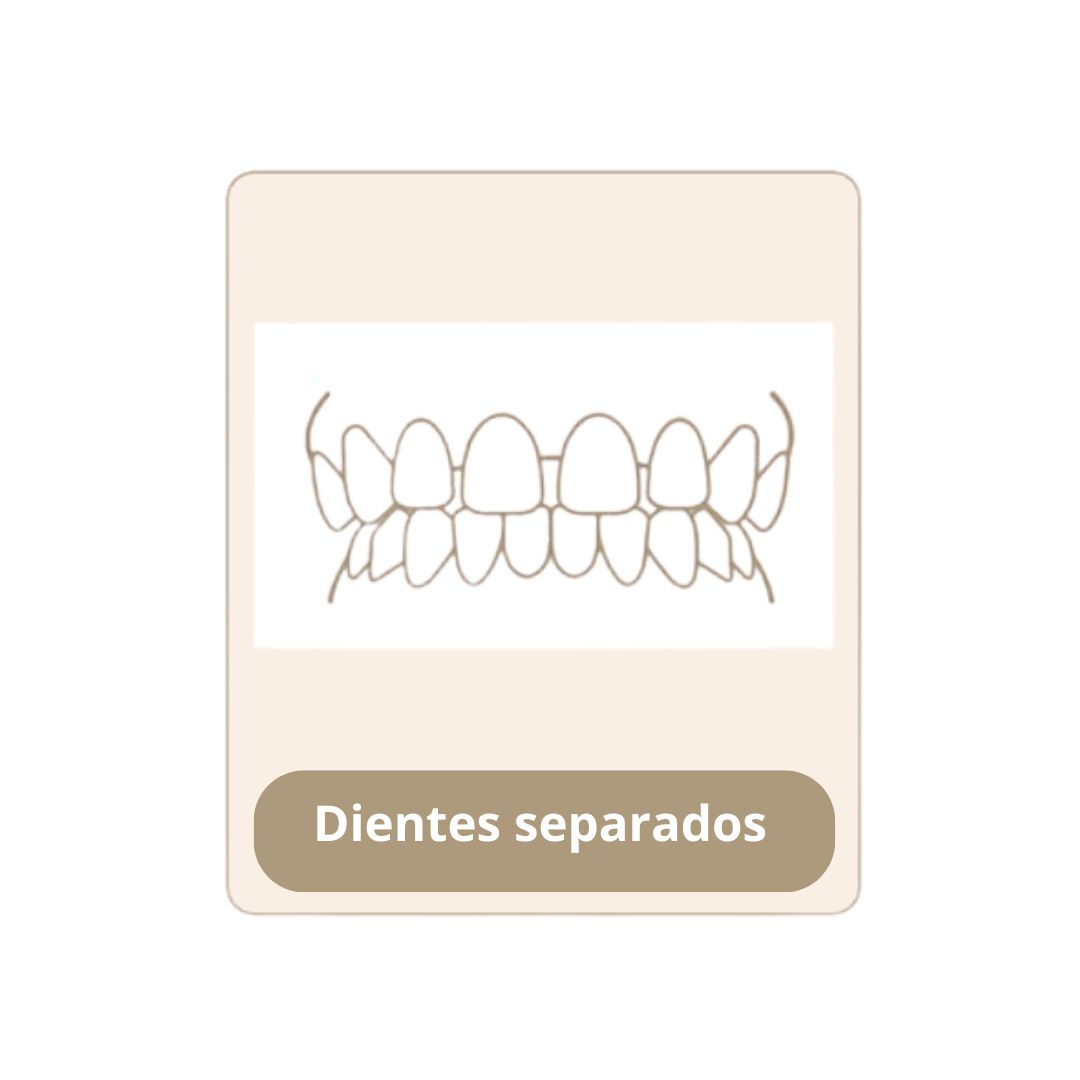 Dientes Separados_First Dental