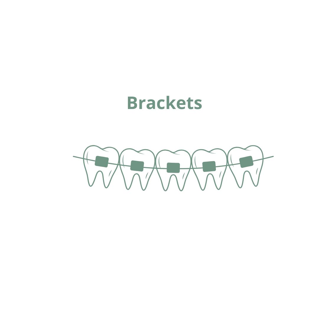 Ortodoncia con Brackets en Valladolid