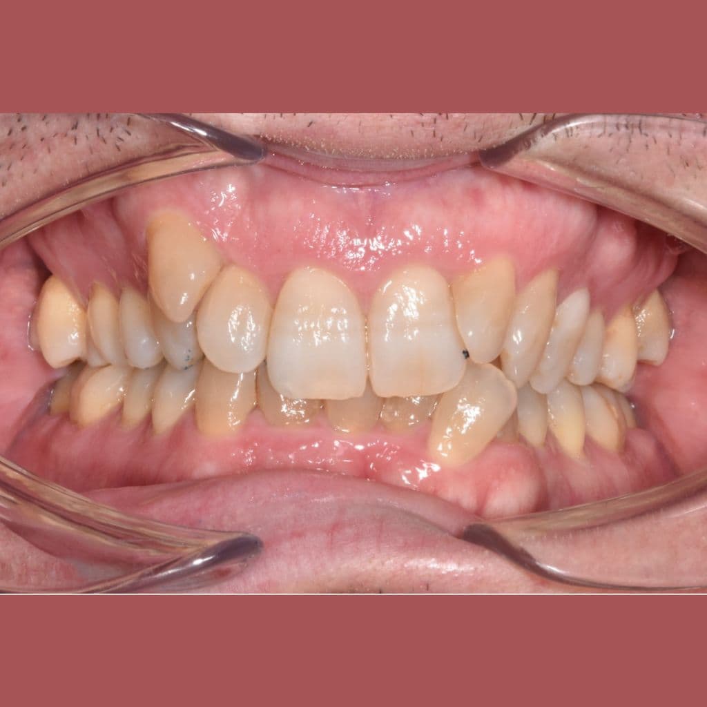 Clínica Dental Ikigai en el Cañaveral_Antes