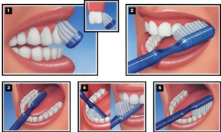 dientes blancos y saludables