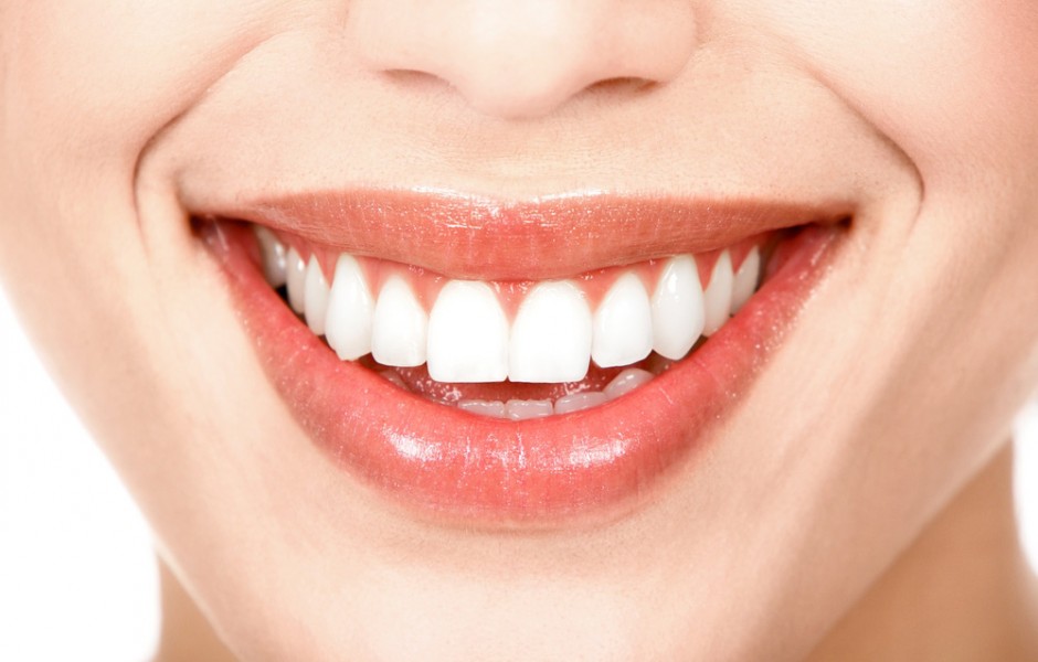 Blanqueamiento Dental