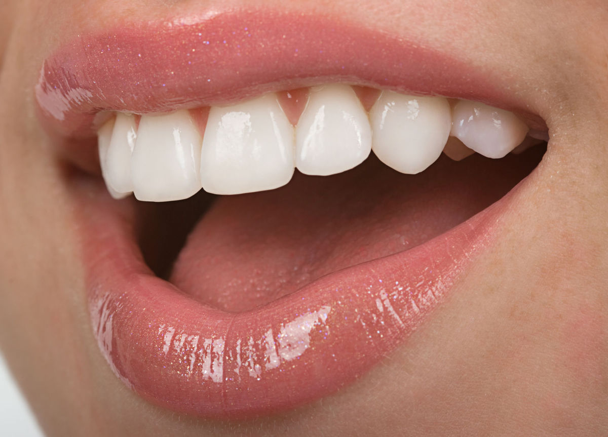 Club Dental Garantía de Clínica - Dentista de Confianza - Dientes