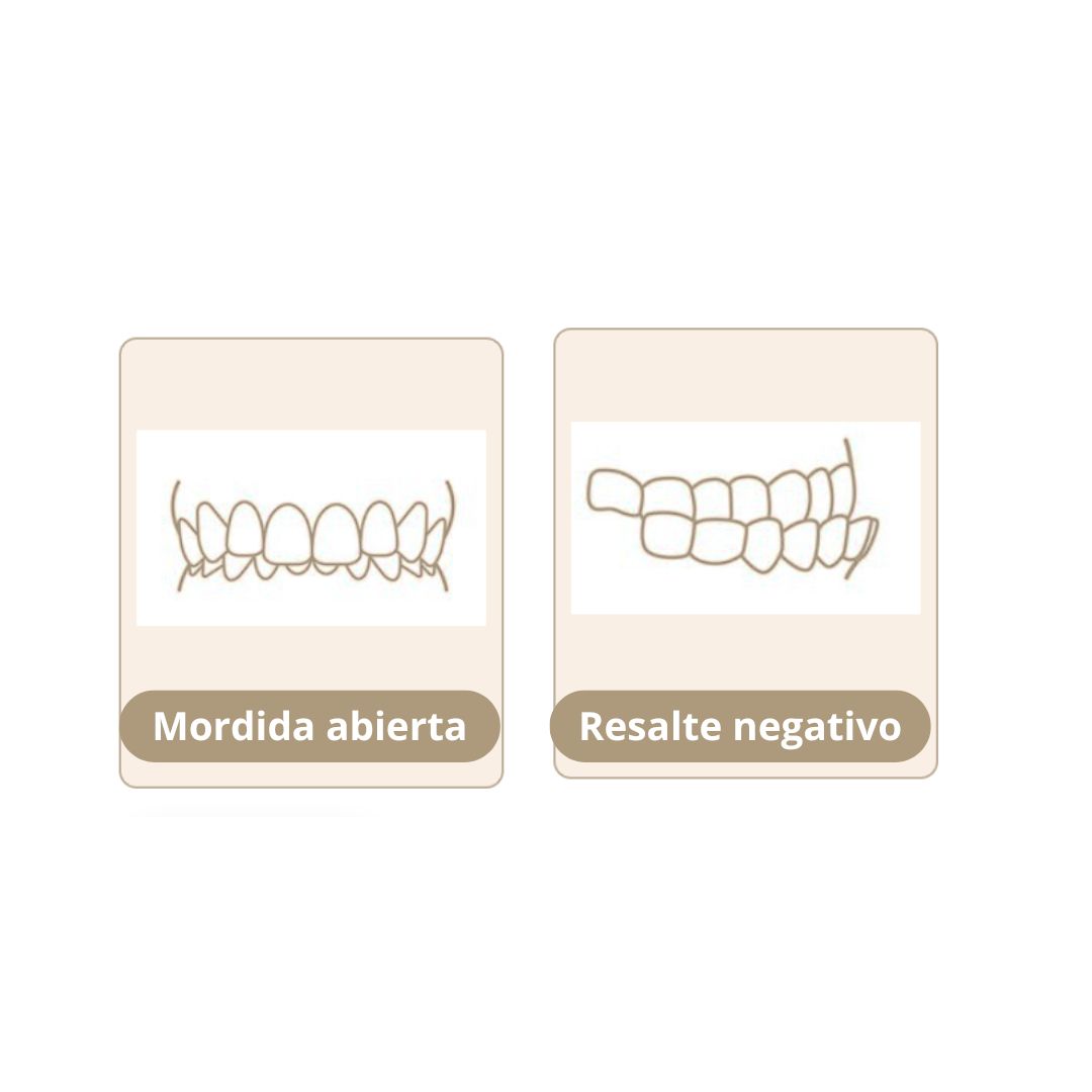 Tipo de mordidas en First dental