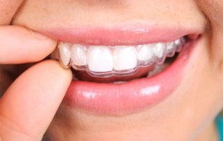 Garantía de Clínica - Dentistas de Confianza - Ortodoncia Invisalign
