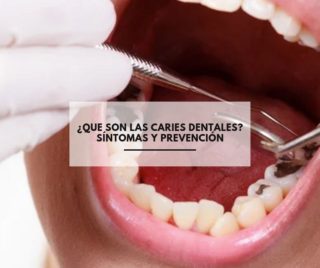 ¿Que son las caries dentales? Síntomas y prevención