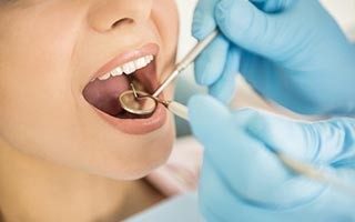 Club Dental Garantía de Clínica - Dentista de Confianza - Tratamiento de Caries Dental
