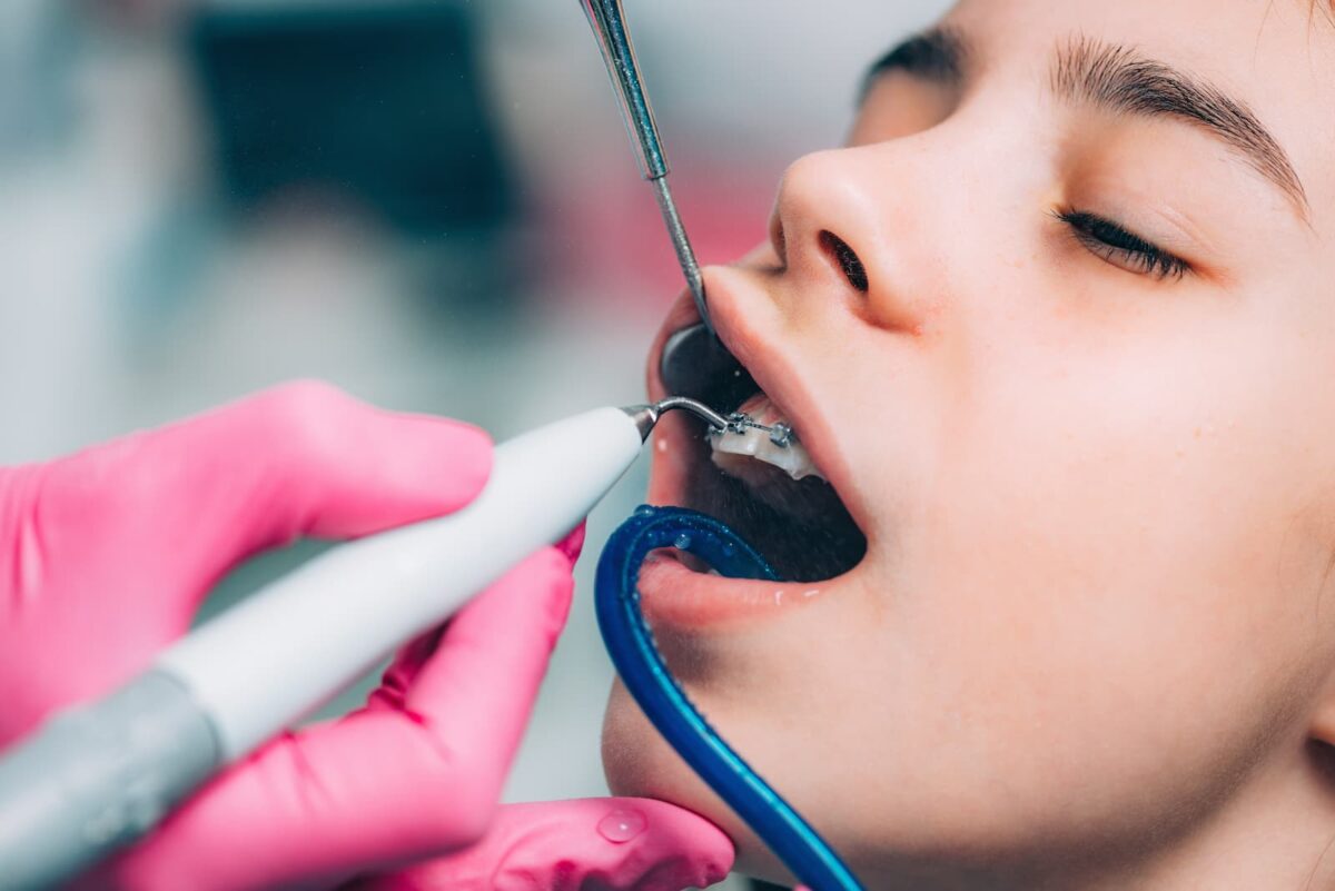 cómo-cuidar-tus-dientes-durante-el-tratamiento-de-ortodoncia-1200x801.jpg
