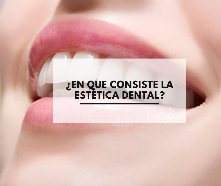 ¿Qué-beneficios-tiene-el-Invisalign-frente-a-otros-tratamientos_-77.jpg